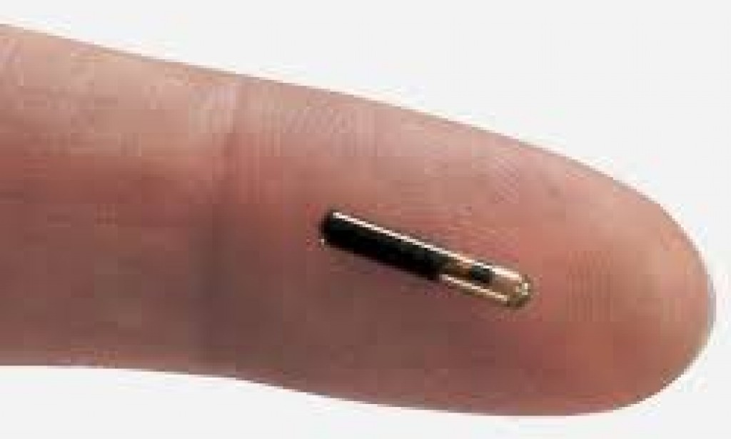 These are the Reasons I'm Against Implantation of Microchip, not that it is the Mark of the Beast