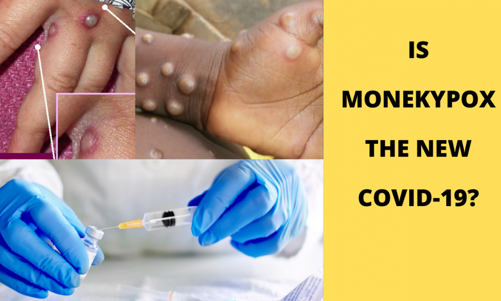 Is Monekypox the new Covid-19: Countries have started Stockpiling Vaccines.