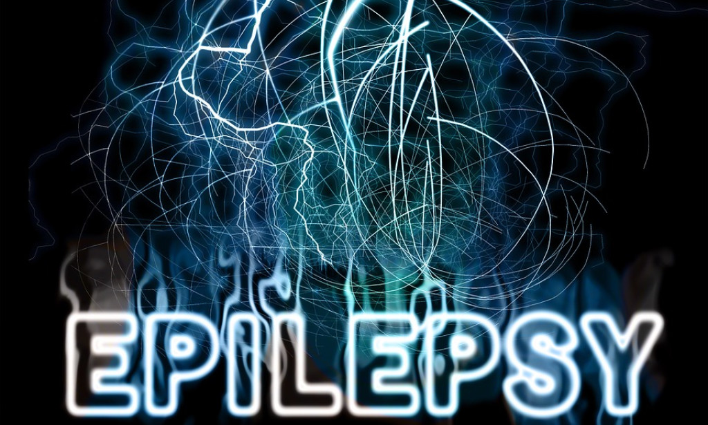 What to do if someone has a seizure or Fit